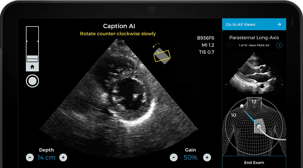 Caption Health AI Awarded FDA Clearance for Point-of-Care Ejection Fraction Evaluation 