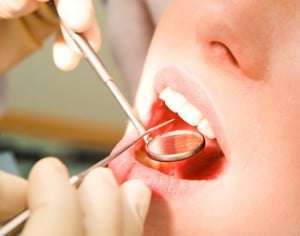 Dental implants with Denefits