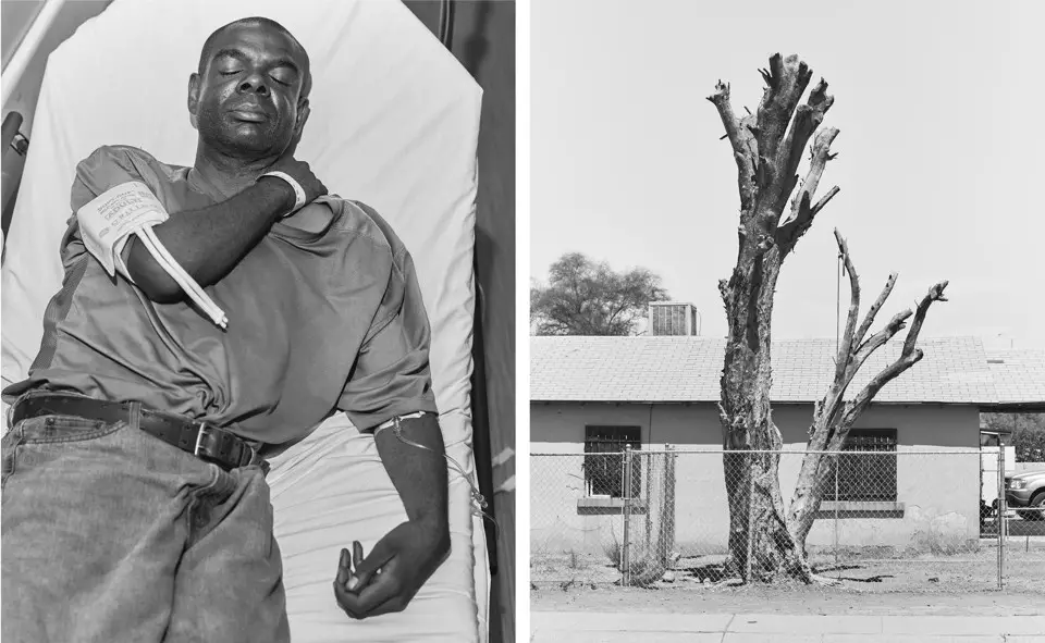 man dehydrated in hospital and tree with no limbs