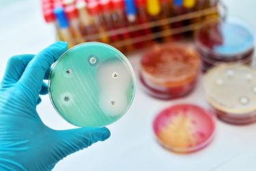 Antimicrobial susceptibility testing in petri dish - idea of antibiotic resistant bacteria
