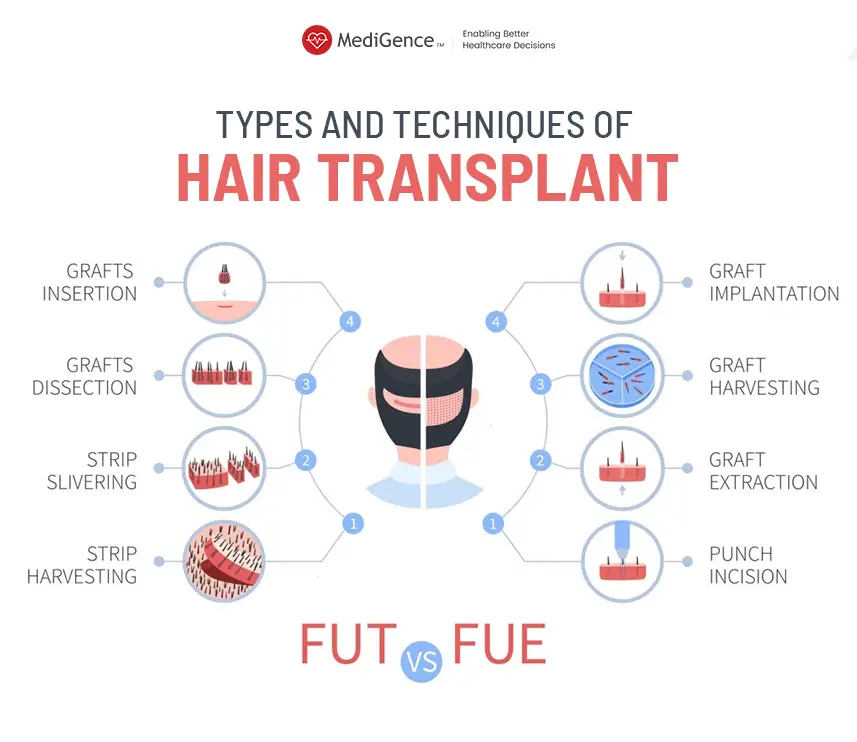 Hair Transplant Types in Turkey