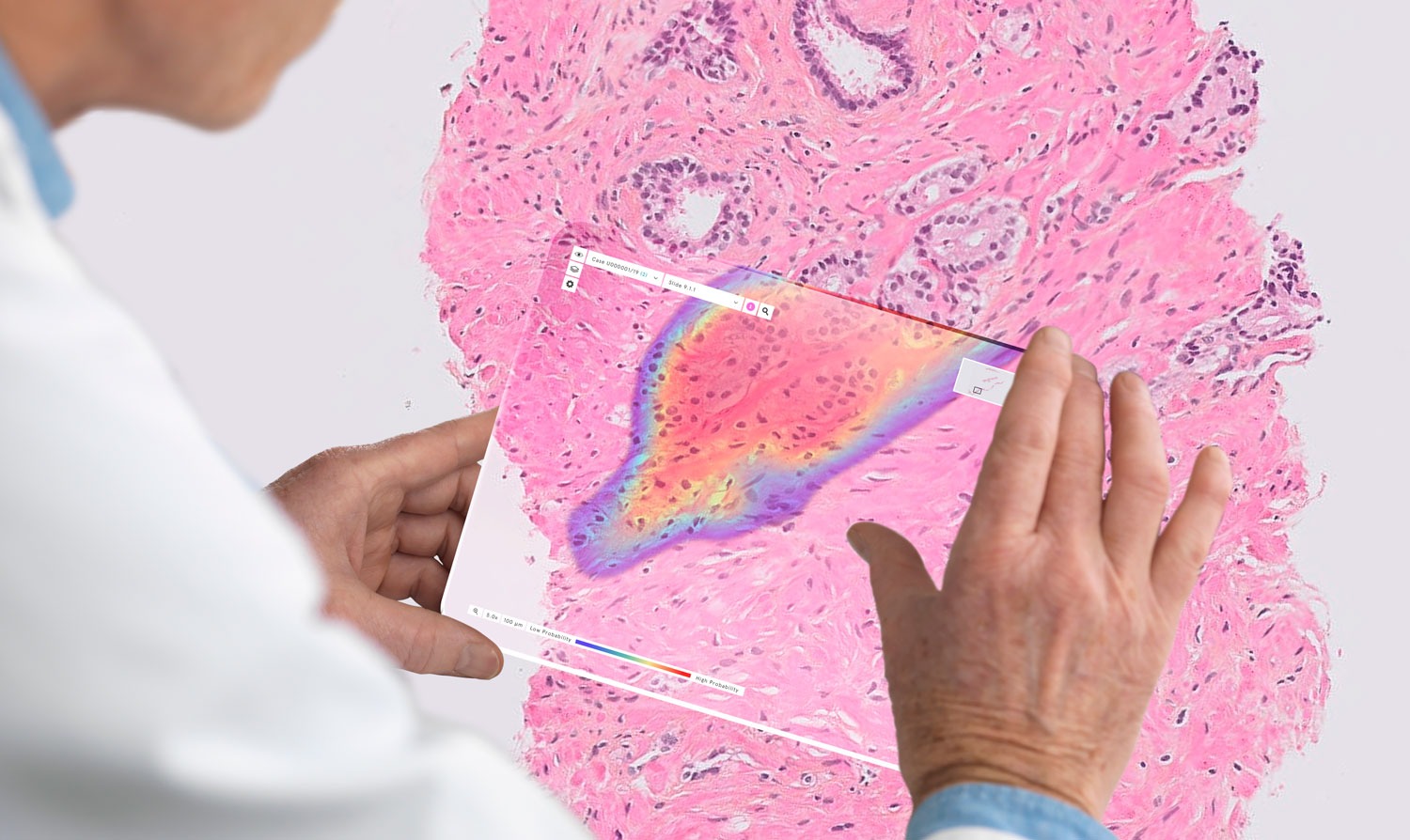 HLTH21: Roche, Ibex Medical Partner to Develop AI-Powered Digital Pathology Apps