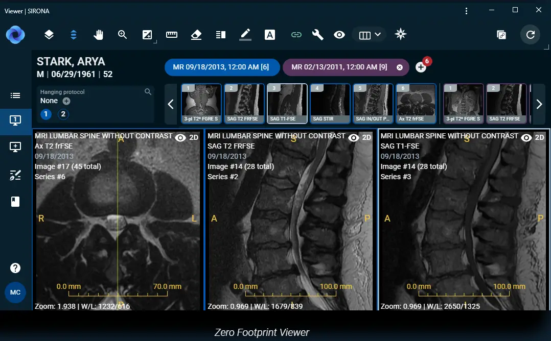 Sirona Medical Secures $40M for Cloud-Native Radiology Operating System