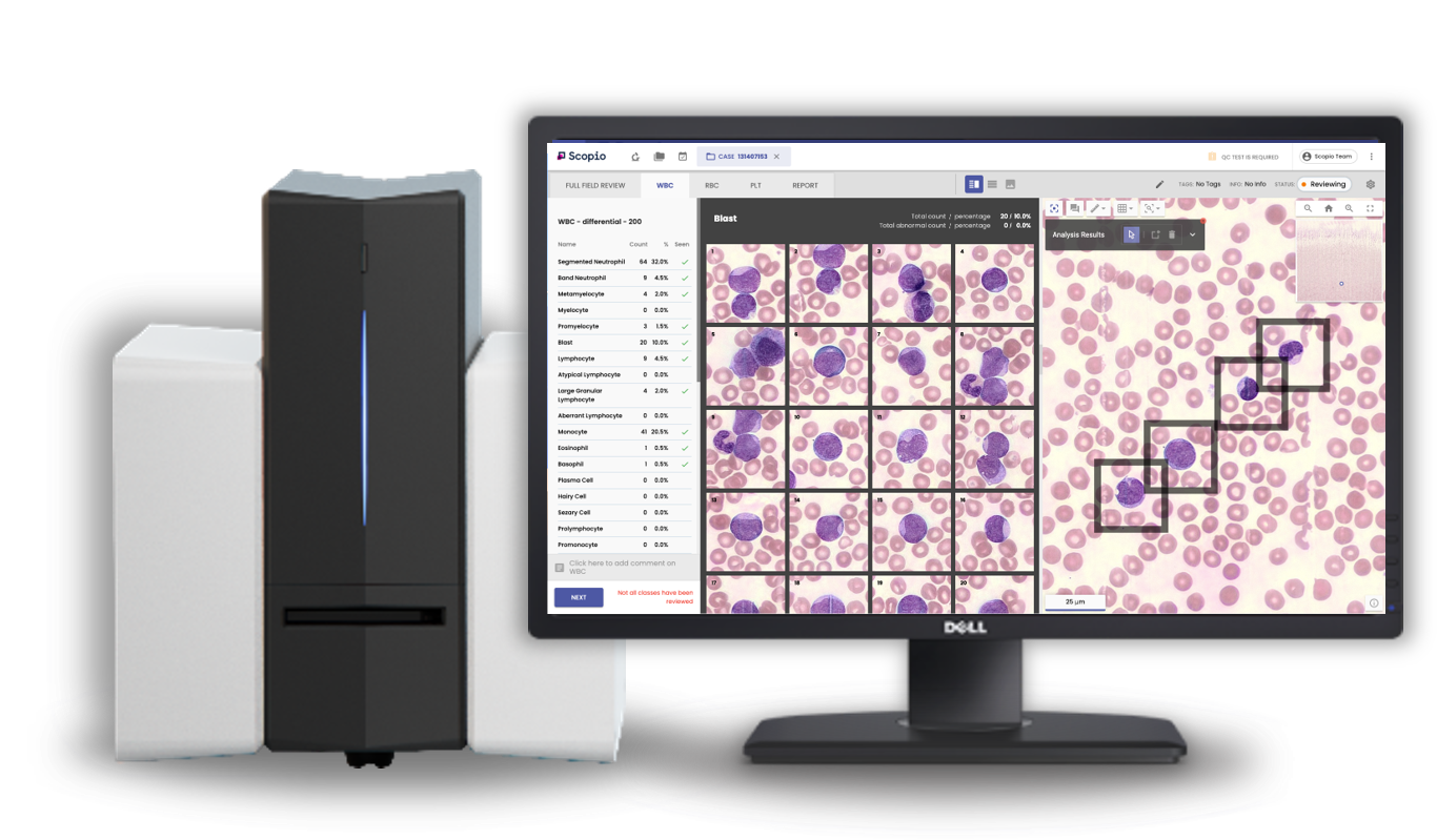 Scopio Secures $50M for AI-Powered Peripheral Blood Smear App
