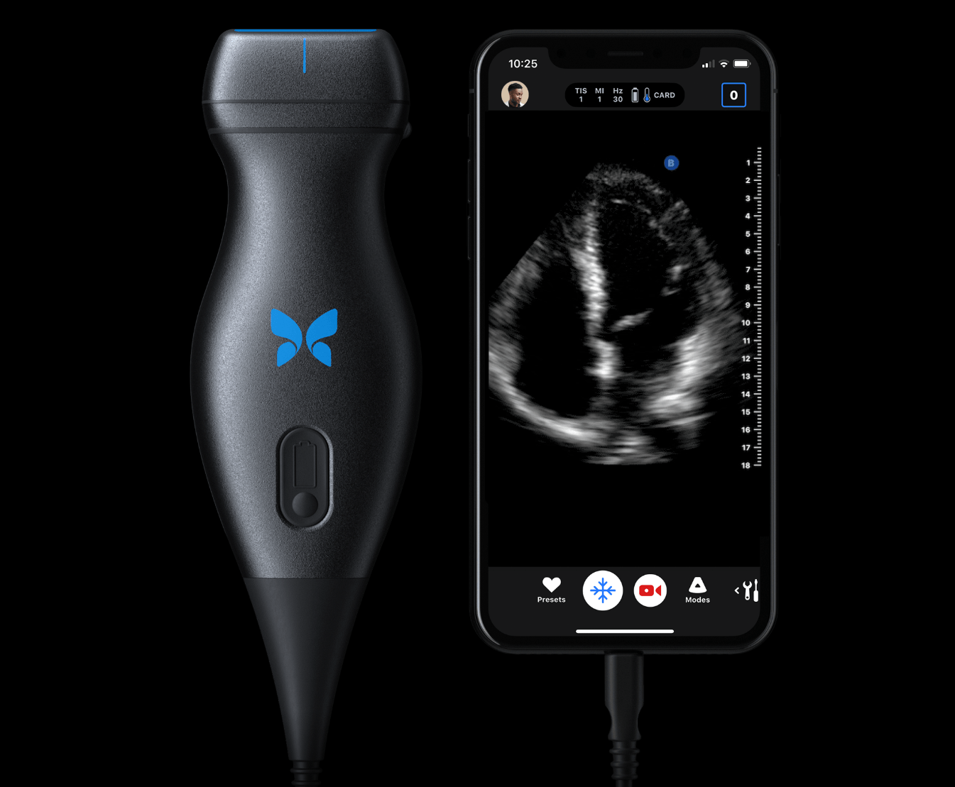 Butterfly iQ Expands Whole-Body Ultrasound System to Android Devices