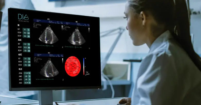 DiA Imaging Analysis Partners with Intel to Improve Ultrasound Analysis by 40%