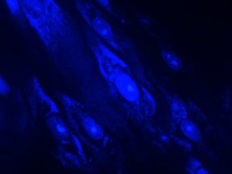 Mycoplasma contaminated cells stained with a blue dye